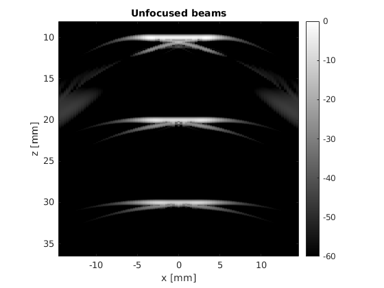 ../../_images/unfocused_beamformed_data.png